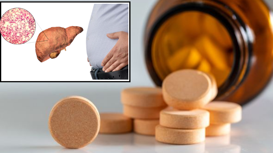 Best Liver Supplements For Fatty Liver